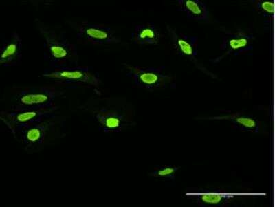Immunocytochemistry/Immunofluorescence: SSB Antibody [H00006741-B01P-50ug] - Purified MaxPab antibody to SSB on HeLa cell. [antibody concentration 10 ug/ml]