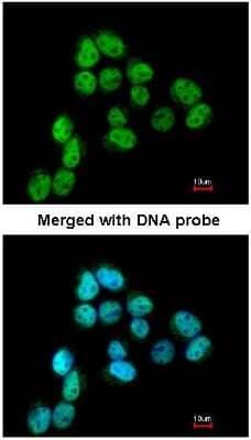 Immunocytochemistry/Immunofluorescence: SSB Antibody [NBP1-33549] - Analysis of paraformaldehyde-fixed A431, using SSB (NBP1-33549) antibody at 1:200 dilution.