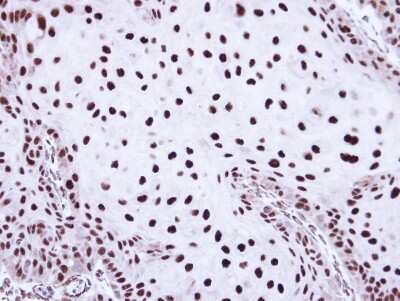 Immunohistochemistry-Paraffin: SSB Antibody [NBP1-33549] - Paraffin-embedded Cal27 Xenograft, using antibody at 1:100 dilution.