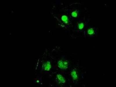 Immunocytochemistry/Immunofluorescence: SSB Antibody (OTI2C8) - Azide and BSA Free [NBP2-74356] - Staining of COS7 cells transiently transfected by pCMV6-ENTRY SSB.