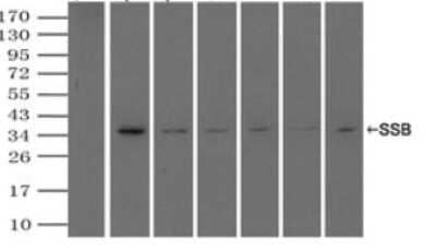 Immunoprecipitation: SSB Antibody (OTI2C8) - Azide and BSA Free [NBP2-74356] - (Negative control: IP without adding anti-SSB antibody.). For each experiment, 500ul of DDK tagged SSB overexpression lysates (at 1:5 dilution with HEK293T lysate), 2ug of anti-SSB antibody and 20ul (0.1mg) of goat anti-mouse conjugated magnetic beads were mixed and incubated overnight. After extensive wash to remove any non-specific binding, the immuno-precipitated products were analyzed with rabbit anti-DDK polyclonal antibody.