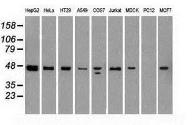 Western Blot: SSB Antibody (OTI2C8) - Azide and BSA Free [NBP2-74356] - Analysis of extracts (35ug) from 9 different cell lines by using anti-SSB monoclonal antibody.