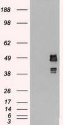 Western Blot: SSB Antibody (OTI2C8) - Azide and BSA Free [NBP2-74356] - HEK293T cells were transfected with the pCMV6-ENTRY control (Left lane) or pCMV6-ENTRY SSB (Right lane) cDNA for 48 hrs and lysed. Equivalent amounts of cell lysates (5 ug per lane) were separated by SDS-PAGE and immunoblotted with anti-SSB.