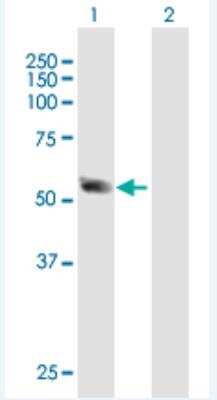 Western Blot: SSB Antibody [H00006741-B01P-50ug] -  Analysis of SSB expression in transfected 293T cell line (H00006741-T01) by SSB MaxPab polyclonal antibody.  Lane 1: SSB transfected lysate(44.88 KDa). Lane 2: Non-transfected lysate.