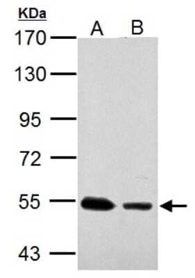 Western Blot: SSB Antibody [NBP1-33549] - Sample (30 ug of whole cell lysate) A: JC B: C2C12 7. 5% SDS PAGE, antibody diluted at 1:10000.