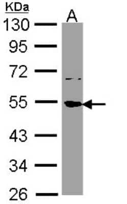 Western Blot SSB Antibody