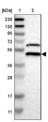 Western Blot SSB Antibody