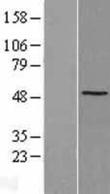 Western Blot SSB Overexpression Lysate