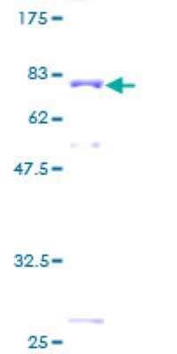 SDS-PAGE Recombinant Human SSB GST (N-Term) Protein