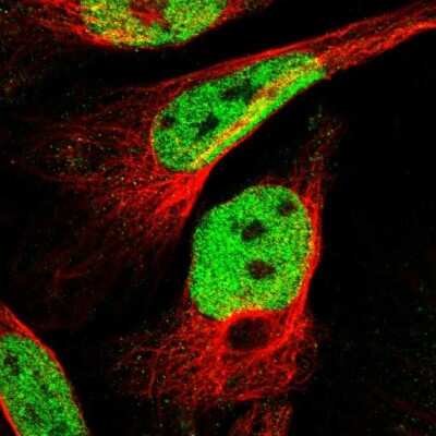 Immunocytochemistry/Immunofluorescence: SSBIP1/SOSS-C Antibody [NBP1-81682] - Immunofluorescent staining of human cell line U-2 OS shows localization to nucleoplasm. Antibody staining is shown in green.