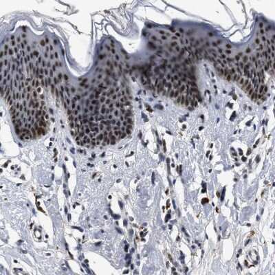 Immunohistochemistry-Paraffin: SSBIP1/SOSS-C Antibody [NBP1-81682] - Staining of human skin shows strong nuclear positivity in keratinocytes.