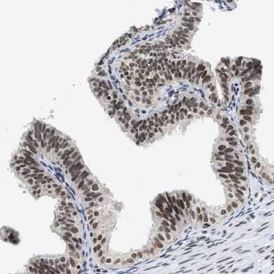 Immunohistochemistry-Paraffin: SSBIP1/SOSS-C Antibody [NBP1-81682] - Staining of human fallopian tube shows strong nuclear positivity in glandular cells.