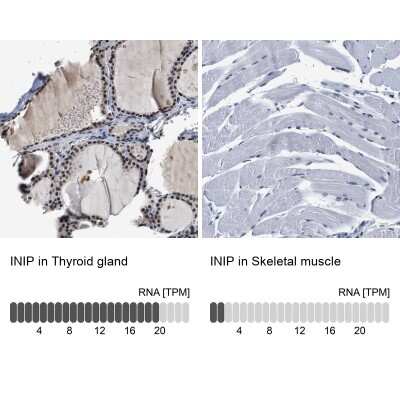 Immunohistochemistry-Paraffin SSBIP1/SOSS-C Antibody - BSA Free