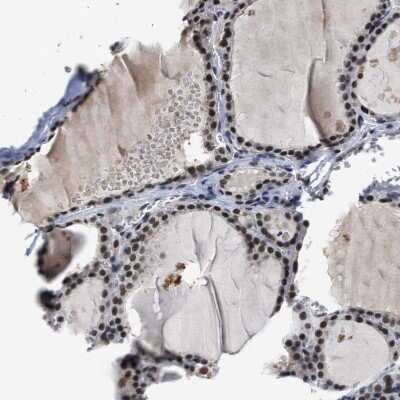 Immunohistochemistry-Paraffin: SSBIP1/SOSS-C Antibody [NBP1-81682] - Staining of human thyroid gland shows nuclear positivity in glandular cells.