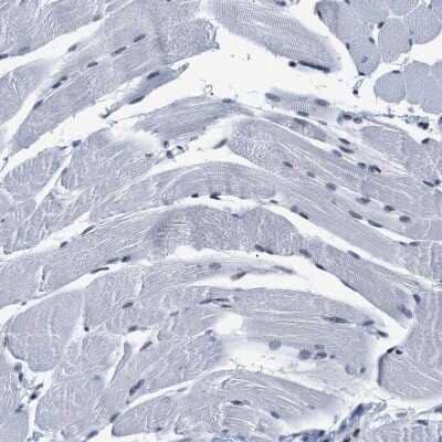 Immunohistochemistry-Paraffin: SSBIP1/SOSS-C Antibody [NBP1-81682] - Staining of human skeletal muscle shows no positivity in myocytes as expected.