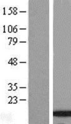 Western Blot: SSBIP1/SOSS-C Overexpression Lysate (Adult Normal) [NBL1-08602] Left-Empty vector transfected control cell lysate (HEK293 cell lysate); Right -Over-expression Lysate for SSBIP1/SOSS-C.