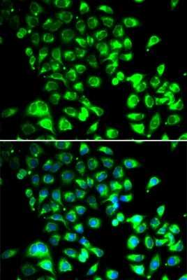 Immunocytochemistry/Immunofluorescence: SSBP1 Antibody [NBP2-95237] - Analysis of U2OS cells using SSBP1 . Blue: DAPI for nuclear staining.