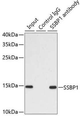 Immunoprecipitation: SSBP1 Antibody [NBP2-95237] - Analysis of 200ug extracts of MCF7 cells using 1ug SSBP1 antibody.  Western blot was performed from the immunoprecipitate using SSBP1 antibody at a dilition of 1:1000.