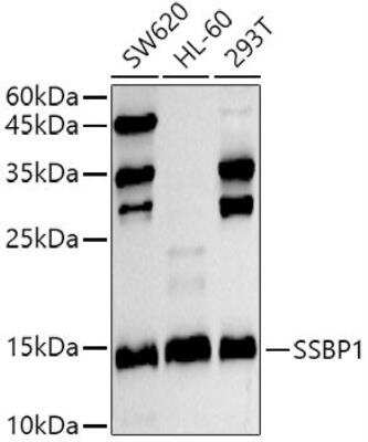 Western Blot: SSBP1 Antibody [NBP2-95237] - Analysis of extracts of various cell lines, using SSBP1 antibody at 1:500 dilution.Secondary antibody: HRP Goat Anti-Rabbit IgG (H+L) at 1:10000 dilution.Lysates/proteins: 25ug per lane. Blocking buffer: 3% nonfat dry milk in TBST.Detection: ECL Basic Kit. Exposure time: 30s.