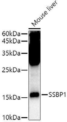 Western Blot: SSBP1 Antibody [NBP2-95237] - Analysis of extracts of Mouse liver, using SSBP1 antibody at 1:500 dilution.Secondary antibody: HRP Goat Anti-Rabbit IgG (H+L) at 1:10000 dilution.Lysates/proteins: 25ug per lane. Blocking buffer: 3% nonfat dry milk in TBST.Detection: ECL Enhanced Kit. xposure time: 90s.