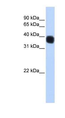 Western Blot: SSBP3 Antibody [NBP1-56591] - MCF-7 whole cell lysates, concentration 0.2-1 ug/ml.