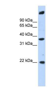 Western Blot: SSBP3 Antibody [NBP1-56606] - Jurkat cell lysate, concentration 0.2-1 ug/ml.