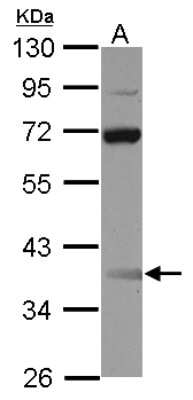 Western Blot: SSBP3 Antibody [NBP2-20487] - Sample (30 ug of whole cell lysate) A: Raji 10% SDS PAGE gel, diluted at 1:1000.
