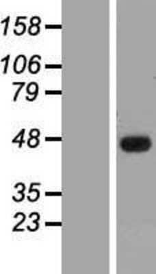 Western Blot: SSBP3 Overexpression Lysate (Adult Normal) [NBL1-16467] Left-Empty vector transfected control cell lysate (HEK293 cell lysate); Right -Over-expression Lysate for SSBP3.