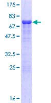 SDS-Page: SSBP3 Recombinant Protein [H00023648-P01]