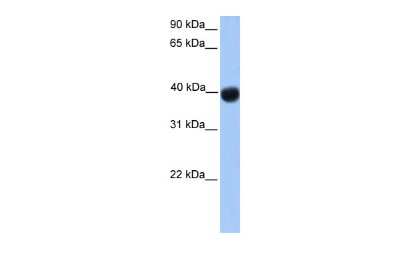 Western Blot: SSBP4 Antibody [NBP2-84283] - WB Suggested Anti-SSBP4 Antibody Titration: 0.2-1 ug/ml. Positive Control: Transfected 293T