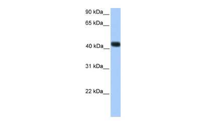 Western Blot: SSBP4 Antibody [NBP2-84284] - WB Suggested Anti-SSBP4 Antibody Titration: 0.2-1 ug/ml. Positive Control: Transfected 293T
