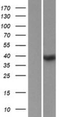 Western Blot: SSBP4 Overexpression Lysate (Adult Normal) [NBP2-05985] Left-Empty vector transfected control cell lysate (HEK293 cell lysate); Right -Over-expression Lysate for SSBP4.