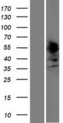Western Blot: SSBP4 Overexpression Lysate (Adult Normal) [NBP2-08758] Left-Empty vector transfected control cell lysate (HEK293 cell lysate); Right -Over-expression Lysate for SSBP4.