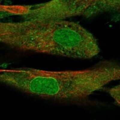 Immunocytochemistry/Immunofluorescence: SSC5D Antibody [NBP3-17626] - Staining of human cell line ASC TERT1 shows localization to nucleoplasm, nuclear membrane & plasma membrane.