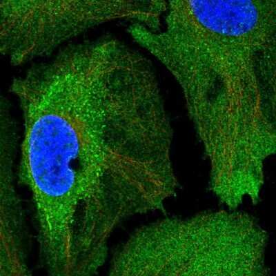 Immunocytochemistry/Immunofluorescence: SSFA2 Antibody [NBP2-56783] - Staining of human cell line HeLa shows localization to plasma membrane & cytosol.