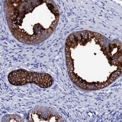 Immunohistochemistry: SSFA2 Antibody [NBP2-48718] - Staining of human prostate shows strong cytoplasmic positivity in glandular cells.