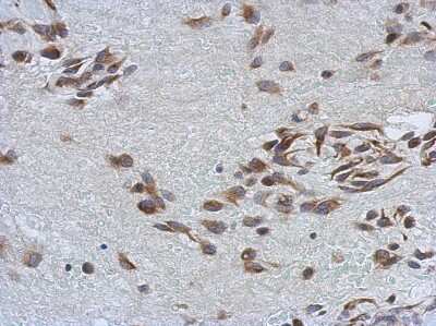 Immunohistochemistry-Paraffin SSFA2 Antibody