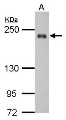 Western Blot SSFA2 Antibody