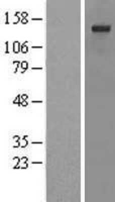 Western Blot: SSFA2 Overexpression Lysate (Adult Normal) [NBL1-16469] Left-Empty vector transfected control cell lysate (HEK293 cell lysate); Right -Over-expression Lysate for SSFA2.