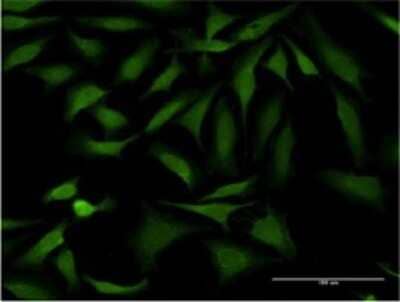 Immunocytochemistry/Immunofluorescence: SSH1 Antibody (1D2) [H00054434-M02] - Analysis of monoclonal antibody to SSH1 on HeLa cell . Antibody concentration 10 ug/ml.