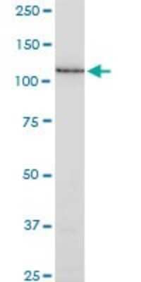 Western Blot: SSH1 Antibody (1D2) [H00054434-M02] - SSH1 monoclonal antibody (M02), clone 1D2. Analysis of SSH1 expression in HeLa.