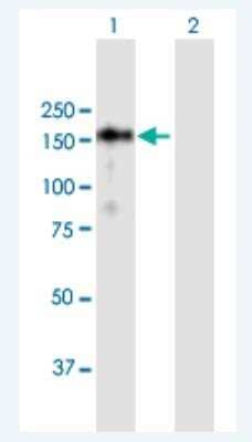 Western Blot: SSH1 Antibody [H00054434-B01P-50ug] - Analysis of SSH1 expression in transfected 293T cell line (H00054434-T01) by SSH1 MaxPab polyclonal antibody.  Lane1:SSH1 transfected lysate(115.39 KDa). Lane2:Non-transfected lysate.