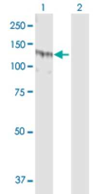 Western Blot: SSH1 Antibody [H00054434-D01P] - Analysis of SSH1 expression in transfected 293T cell line by SSH1 polyclonal antibody.Lane 1: SSH1 transfected lysate(115.50 KDa).Lane 2: Non-transfected lysate.