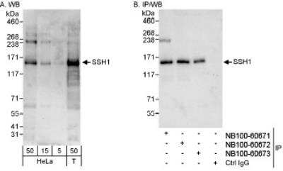 Western Blot: SSH1 Antibody [NB100-60671] - Detection of Human SSH1 on HeLa whole cell lysate using NB100-60671. SSH1 was also immunoprecipitated by rabbit anti-SSH1 antibodies NB100-60672 and NB100-60673.