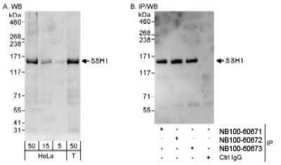 <b>Independent Antibodies Validation and Biological Strategies Validation.</b>Western Blot: SSH1 Antibody [NB100-60673] - Detection of Human SSH1 on HeLa whole cell lysate using NB100-60673. SSH1 was also immunoprecipitated by rabbit anti-SSH1 antibodies NB100-60671 and NB100-60672.