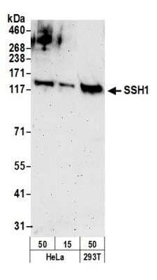 Western Blot: SSH1 Antibody [NB100-60673] - Detection of Human SSH1 by Western Blot. Samples: Whole cell lysate (15 and 50 ug) from HeLa and (50 ug) from 293T cells prepared using NETN lysis buffer. Antibody: Affinity purified rabbit anti-SSH1 antibody NB100-60673 used for WB at 0.1 ug/ml. Detection: Chemiluminescence with an exposure time of 3 minutes.