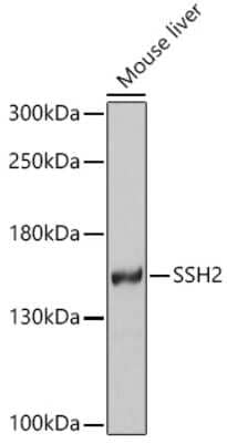 Western Blot SSH2 Antibody - BSA Free