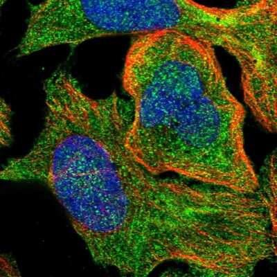 Immunocytochemistry/Immunofluorescence: SSH3 Antibody [NBP1-83805] - Immunofluorescent staining of human cell line U-2 OS shows localization to plasma membrane, cytosol & actin filaments.