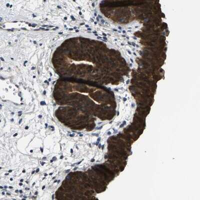 Immunohistochemistry-Paraffin: SSH3 Antibody [NBP1-83804] - Staining of human urinary bladder shows strong cytoplasmic positivity in urothelial cells.