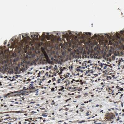 Immunohistochemistry-Paraffin: SSH3 Antibody [NBP1-83805] - Staining of human urinary bladder shows strong cytoplasmic positivity in urothelial cells.